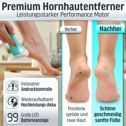 Grundig Electric Callus Remover Pro - quickly remove calluses without bending over - Premium cordless callus remover wet + dry with work light, 3 foot rollers, rechargeable (callus remover)