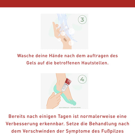N1 Athlete's Foot Gel 30ml - Medical Device - Relieves Itching &amp; Protects Against Unpleasant Odors - Athlete's Foot Cream for Athlete's Foot Treatment with Active Ingredient Natilact - Powerful Remedy for Athlete's Foot