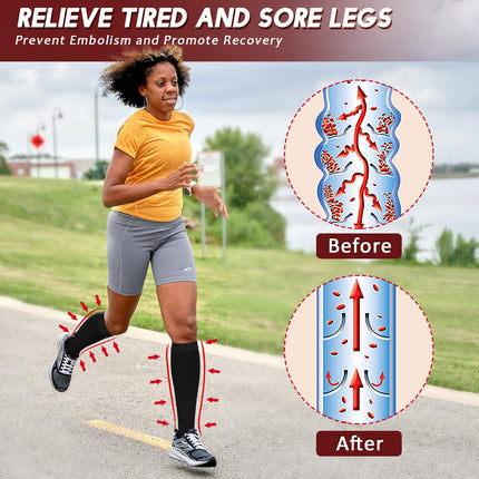 Ailaka Compression Socks for Men and Women, 20-30 mmHg Medical Knee High Socks, Open Toe Socks for Varicose Veins, Edema, Recovery, Pregnant Women, Nurse