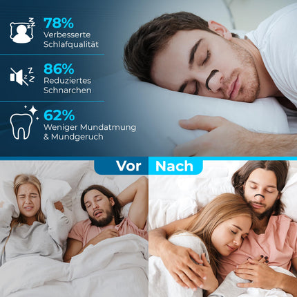 Magnetic Nose Strips Snoring (Starter Kit 15 Days) – Anti-Snoring Nose Strips, Snore Stopper &amp; Snoring Splint for Better Breathing, Nasal Strips &amp; Nose Strips Magnet