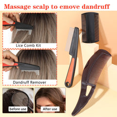 Nogeqi 3 Pack Lice Comb Stainless Steel, Dandruff Comb Nits Comb Extra Fine, Dandruff Scalp Comb, Dandruff Comb Scalp Comb Cat Comb Dog Comb Scab Comb for People Clean Scalp Adults