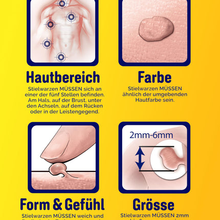 Scholl Freeze Away Wart Remover Set, removes skin tags in 1 treatment, clinically proven to remove warts on the neck, chest, armpit, back and groin, 12 treatments
