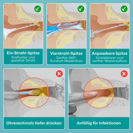 Medi Grade Ear Cleaning - Earwax Remover - Safe Pump for Earwax Removal 300 ml - Environmentally Friendly Ear Cleaning Set - Improves Hearing
