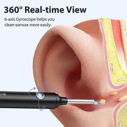 Earwax Remover Otoscope Hopefox 1080P WiFi Ear Cleaner, 360° Wide Angle Otoscope Camera for Adults, Children and Pets with Dust Cover