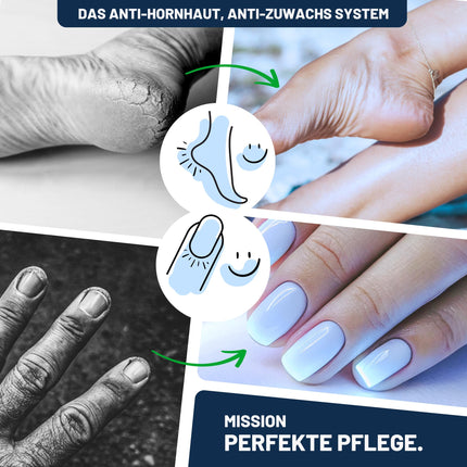 Mr. Fuss Callus Remover Solution for Gentle Callus Removal. Fast-Softening Lotion 250ml No. 4 in the Plus Pack. Foot Care Pedicure Set without Sanding with Instant Effect.