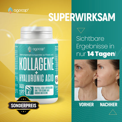 Collagen Capsules - Hyaluronic acid &amp; Collagen complex, 120 capsules. Enriched with coenzyme Q10 and hyaluronic capsules. Collagen for joints and skin. Laboratory tested and registered in Germany.