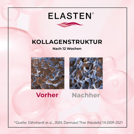 ELASTEN - The study-proven collagen complex for radiant skin from within - Reduces wrinkles - Strengthens connective tissue - The No. 1 from the pharmacy - 28 drinking collagen ampoules of 25 ml each
