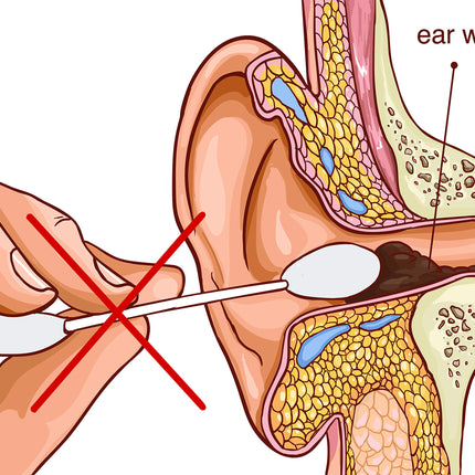 REMOS ear cleaner for hygienic removal of earwax Length 6.5 cm