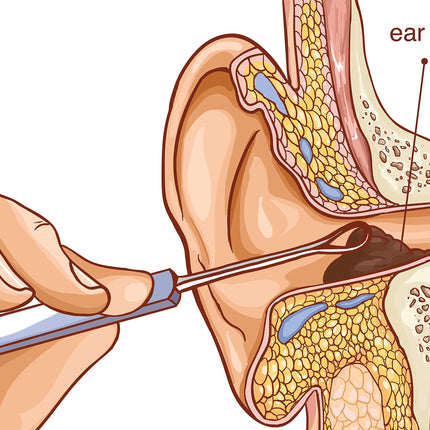 REMOS Ear Cleaner/Ear Loop | Remove earwax easily and safely | Rust-proof, durable stainless steel | 7 cm | Satin